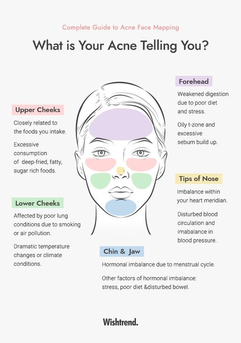 What Different Areas Of Acne Mean, What Does Ur Acne Mean, What My Acne Is Telling Me, Why Acne Is Where It Is, Where Ur Acne Is Meaning, Reasons Why You Have Acne, What Does Acne On Your Forehead Mean, What Is Causing My Acne, What Ur Acne Mean