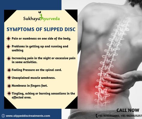 Numbness In Fingers, Slip Disc, Homeopathy Medicine, Homemade Facials, Muscle Weakness, Sciatic Nerve, Spinal Cord, Visit Website, Sciatica