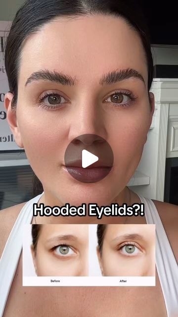 How To Get Rid Of Hooded Eyelids, Eyes Massage, Face Massage Techniques, Hooded Eyelids, Droopy Eyelids, Face Yoga Facial Exercises, Eye Exercises, Face Exercises, Brow Lift