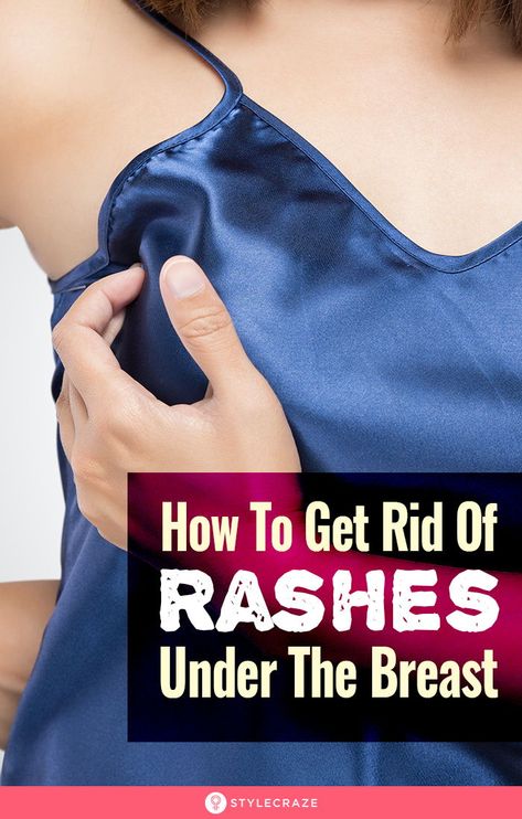 How To Get Rid Of A Rash, Remedies For Heat Rash, Heat Rash Remedy For Adults, How To Reduce Itching After Shaving, Essential Oils For Itchy Rash, Heat Rash Remedy, Red Armpit Rash, Uneven Breast Solution, Home Remedies For Rashes