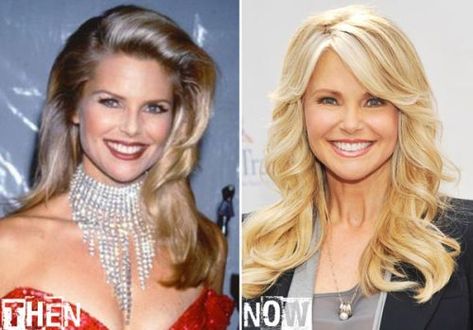 Christie Brinkley Daughter Plastic Surgery | Christie Brinkley before and after plastic surgery Christie Brinkley Plastic Surgery, Christine Brinkley, Christie Brinkley Daughter, Christy Brinkley, Plastic Surgery Pictures, Plastic Surgery Photos, Facial Plastic Surgery, Celebrity Plastic Surgery, Christie Brinkley