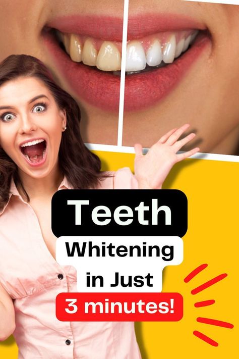 Teeth Whitening in Just 3 Minutes! Surprising Japanese Secrets Whiten Teeth Fast, Baking Soda Teeth Whitening, Teeth Whitening Remedies, Perfect Teeth, Teeth Health, Stronger Teeth, Gum Care, Natural Teeth Whitening, The Dentist