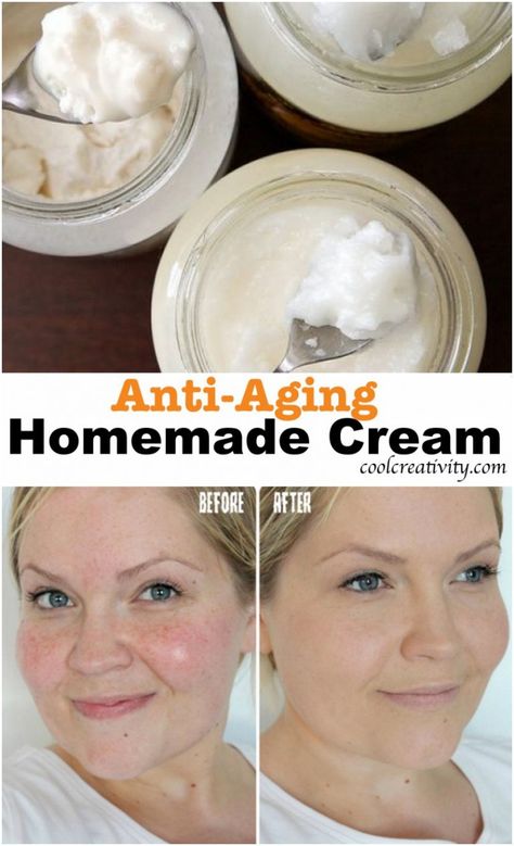 Simple Ingredients for Homemade Anti-Aging Cream Anti Aging Face Mask Diy, Homemade Anti Wrinkle Cream, Diy Anti Aging Cream, Anti Aging Homemade, Homemade Wrinkle Cream, Lotion For Oily Skin, Homemade Face Cream, Tips For Oily Skin, Oily Skin Acne