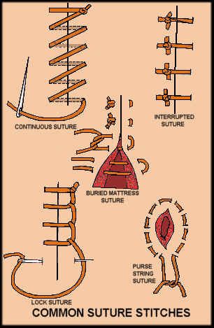 Suture Techniques, Knot Tying, Tech Hacks, Survival Life Hacks, Survival Techniques, Medical Studies, Stitching Techniques, Survival Life, Sew Easy