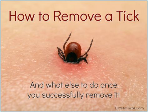 Do you know how to remove a tick? The other day I was bitten so I formulated this plan for a safe, natural removal. Here's how I did it and how you can too! Get Rid Of Ticks, Wood Tick, Tick Removal, Tick Bite, Clean Baking Pans, Tick Repellent, Cleaning Painted Walls, Glass Cooktop, Deep Cleaning Tips