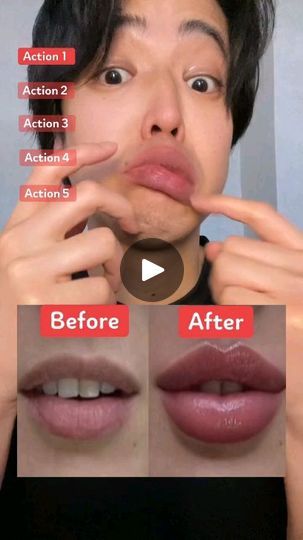 Lips Exercise, Bells Palsy, Small Lips, Forehead Wrinkles, Yoga Facial, Lip Shapes, Perfect Lips, Upper Lip, Face Yoga