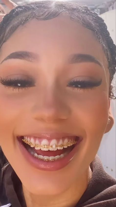 Gold Braces Teeth, Braces For Teeth, Tongue Web Piercing, Braces Colors Ideas, Jewelry Teeth, Braces And Glasses, Gold Braces, Girl Grillz, Teeth Gems