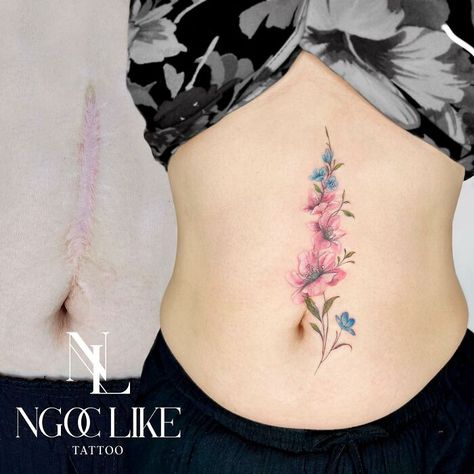 Vertical Tummy Scar Tattoo, Scare Tattoo Cover Ups, Vertical Scar Tattoo Cover Up, Belly Scar Tattoo Cover Up, Chest Scar Tattoo Cover Up, Shoulder Scar Tattoo Cover Up, Vertical Stomach Scar Tattoo Cover Up, Thigh Scar Cover Up Tattoo, Arm Lift Scar Tattoo Cover Up