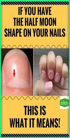 Half Moon Nails, Fitness Healthy Lifestyle, Moon Nails, Moon Shape, Moon Shapes, Homeopathy, Natural Medicine, Do You Know What, Alternative Medicine