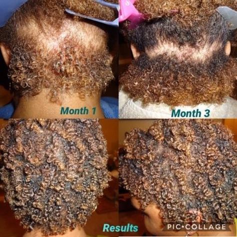 @TreeNaturals posted to Instagram: @Treenaturlas Curly Girl Hair Growth Success Story:   Tree Naturals Tree-O Bundle contains 3 power-house products created specifically for natural hair growth.And trust me, I’ve struggled with dry, color-damaged hair that just wouldn’t grow so I said enough is enough. I knew it was time to make something of value that I could share with you!In as little as three months, you’ll begin to notice:✔Less Knots ✔Less Breakage ✔More Definition ✔More Shine ✔More Growth Plopping Curly Hair, Journal Headers, Cantu Hair Products, Grow Natural Hair Faster, How To Grow Natural Hair, Big Chop, Defined Curls, Curly Hair Routine, Smokey Eyes