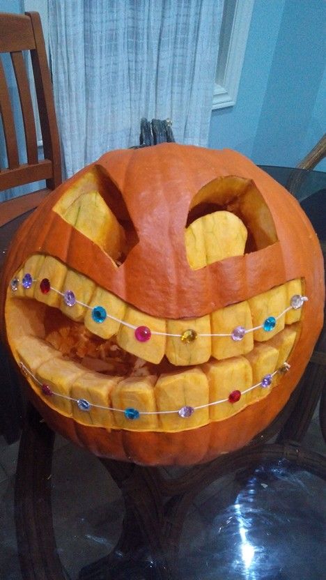 Halloween Pumpkin with braces Dentist Trunk Or Treat, Pumpkin With Braces, Cute Pumpkin Carving Ideas, Dentist Halloween, Pumpkin Carving Tips, Pumpkin Decorating Diy, Pumpkin Cravings, Cute Pumpkin Carving, Halloween Pumpkin Carving