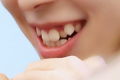 verivery- yeonho smile teeth Yeonho Verivery Smile, Teeth Smile Reference, Rabbit Teeth Smile, Teeth Types, Verivery Yeonho, Types Of Teeth, Rabbit Teeth, Oc Story, Human Features