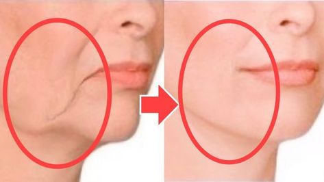 Face Lifting Massage, Face Massage Video, Sagging Jowls, Face Lift Exercises, Face Massage Anti Aging, Sagging Cheeks, Face Massage Techniques, Chin Exercises, Facial Massage Routine