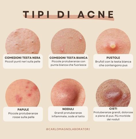 Skin Facts, Survival Skills Life Hacks, Coffee Photos, Healthy Skin Tips, Facial Skin Care Routine, Skin Tips, Skin Care Acne, Skin Care Tools, Face Skin