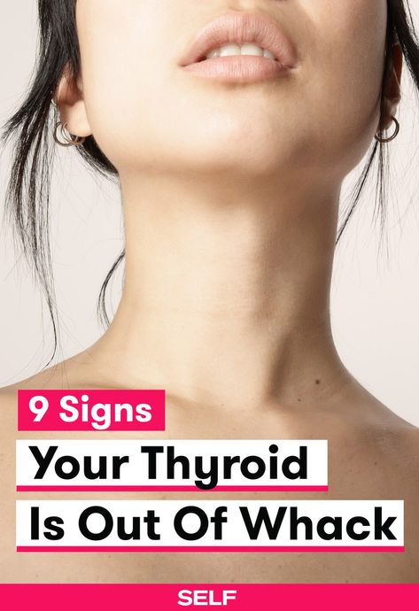 Adrenal Exhaustion, Thyroid Remedies, Low Estrogen Symptoms, Low Thyroid, Thyroid Symptoms, Too Much Estrogen, Thyroid Issues, Thyroid Gland, Hormone Replacement