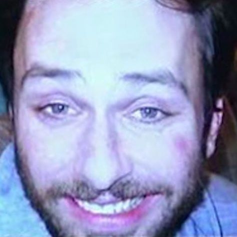 Charlie Kelly, Rats, Instagram Post, Media, Health, Twitter, Beauty, Instagram