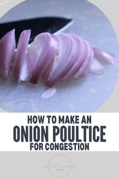 How To Make An Onion Poultice - Natural Remedies Mom Onion Remedies, Onion Poultice, Kfc Gravy Recipe, Health Benefits Of Onions, Benefits Of Onions, Kfc Gravy, Onion Benefits, Onion Benefits Health, Remedies For Inflammation