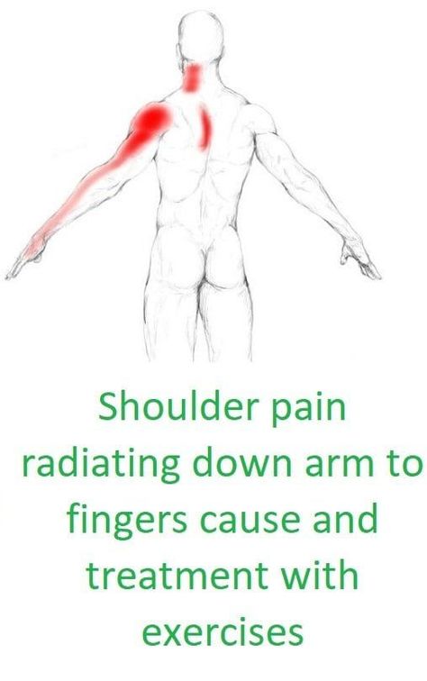 Arm Muscle Pain, Pinched Nerve In Shoulder, Shoulder Pain Remedies, Neck Muscle Pain, Frozen Shoulder Exercises, Bursitis Shoulder, Rotator Cuff Pain, Shoulder Rehab Exercises, Rotator Cuff Exercises