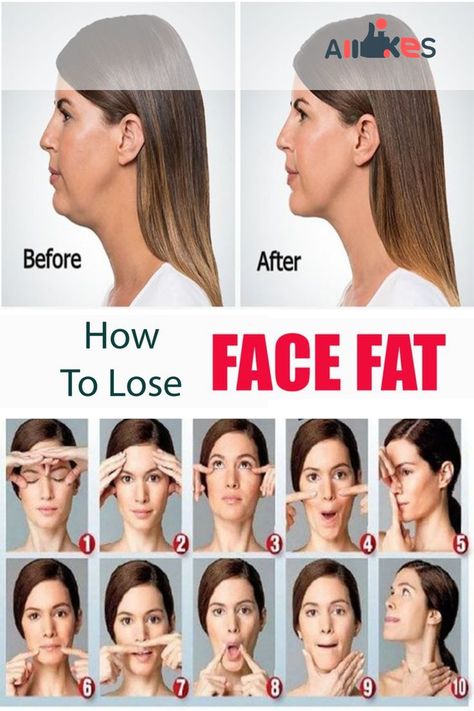 I tried 6 different face exercises everyday for 30 days to try to get a slimmer face. I share my before and after measurements and results. Was it worth it? I have had chubby cheeks for the longest time and it's one of the most asked questions I get. How to Lose Face Fat | Avocadu.com #fitness #healthyface #healthylifestyle Face Exercises To Slim Face Cheeks, Loose Face Fat, Face Fat Loss, Face Fat, Face Yoga Facial Exercises, Facial Yoga, Summer Body Workouts, Slimmer Face, Doodle Ideas