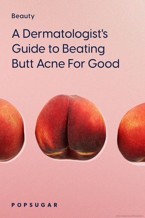 Best Butt-Acne Treatments, According to Dermatologists Smooth Buttocks Skin, How To Get Rid Of Buttocks Acne Quick, How To Get Rid Of Buttocks Acne At Home, How To Get Rid Of Buttocks Acne, But Acne, Body Acne Products, Buttocks Acne, Blind Pimple, Pimples Under The Skin