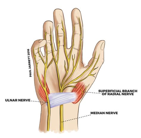 Mr Paul Jarrett | Hand and Wrist Anatomy | Murdoch Orthopaedic Clinic Wrist Muscles Anatomy, Hand Nerves, Wrist Anatomy, Swollen Hands, Carpal Tunnel Exercises, Nerve Anatomy, Radial Nerve, Hand Anatomy, Ulnar Nerve