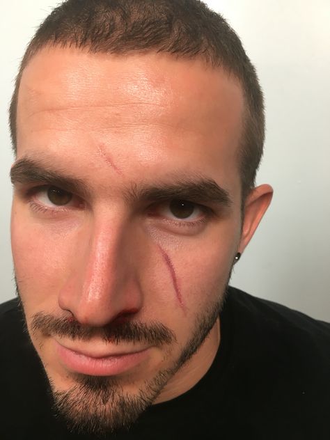 Scar face using rigid collodion Guy With Scar On Face, Face Scar Tattoo, Scar On Face Sketch, Face Scar Eye, Scars On Face Reference Drawing, Scar Face Aesthetic, Facial Scar Reference, Friend Dynamics, Scars Makeup