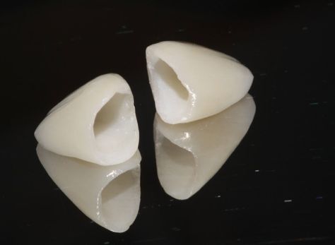 Porcelain crowns Crown Teeth, Ceramic Crown, Teeth Images, Porcelain Crowns, Sensitive Teeth Remedy, Porcelain Veneers, Dental Laboratory, Teeth Shape, Dental Cosmetics