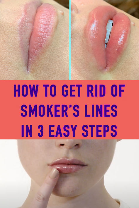 Smokers Lines, Plump Lips Naturally, City Lips, Start Day, Best Smoker, Shaved Hairstyles, Top Anti Aging Products, Short Shaved Hairstyles, Fuller Lips