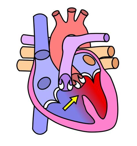 Acting as biomedical engineers, students design, build, test and redesign prototype heart valves using materials such as waterproof tape, plastic tubing, flexible plastic and foam sheets, clay, wire and pipe cleaners. They test them with flowing water, representing blood moving through the heart. As students creatively practice engineering problem solving, they demonstrate their understanding of how one-way heart valves work. Pulmonary Stenosis, Heart Blood Flow, Human Circulatory System, Heart Structure, Heart Diagram, Cardiac Diet, Heart Valves, Congenital Heart Defect, Low Carb Dessert