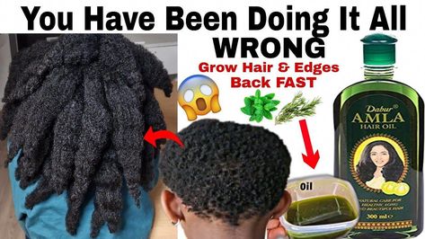 Amal Oil Hair Growth, Amla Oil For Black Hair, How To Use Amla Oil, Amla Oil For Hair Growth 4c Hair, Geritol For Hair Growth, Amla Oil For Hair Growth, Hair Fertilizer, Ayurvedic Hair Growth, Hair Grow Oil