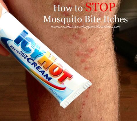 How to STOP Mosquito Bite Itches - Cooking With Ruthie How To Stop Itching From Mosquitos, How To Make Bug Bites Stop Itching, How To Stop Mosquito Bites From Itching, Itchy Mosquito Bite Remedy, Mosquito Bites Stop Itching, Stop Mosquito Bite Itch, Mosquito Bite Remedy, Mosquito Bite Relief, Mosquito Bite Itch