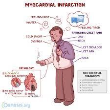 Osmosis - What is the differential diagnosis for a myocardial infarction? Share your answers in the comments. ⬇️ Myocardial infarction (aka heart attack) occurs when a portion of the heart died because Differential Diagnosis, Nursing, Family Guy, Memes, Fictional Characters