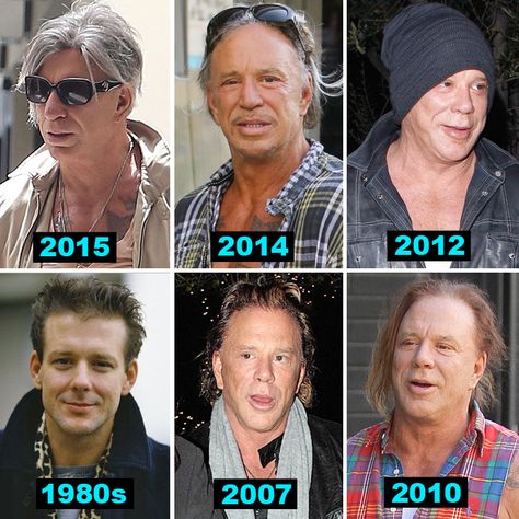 Mickey Rourke Plastic Surgery, Plastic Surgery Photos, Plastic Surgery Gone Wrong, Womens Movement, Mickey Rourke, Celebrities Then And Now, Celebrity Plastic Surgery, Celebrities Before And After, True Grit