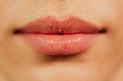 Want to know how to get rid of those annoying little wrinkles around your lips and mouth? The beauty experts at SiO reveal the 11 best ways to treat lip lines. How To Get Rid Of Upper Lip Hair, Lines Around Mouth How To Get Rid, Get Rid Of Upper Lip Hair, How To Get Rid Of Frown Lines By Mouth, Swollen Lips After Kiss, Upper Lip Wrinkles, Makeup Tips To Look Younger, Mouth Wrinkles, Lip Wrinkles