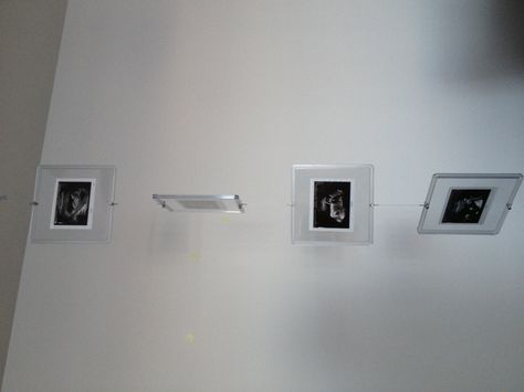 Ultrasound pictures in floating frames Ultrasound Frame Ideas, Picture Frame Ideas, Ultrasound Picture Frame, Ultrasound Frame, Floating Frames, Ultrasound Pictures, Frame Ideas, Ultrasound, Ideas Photo