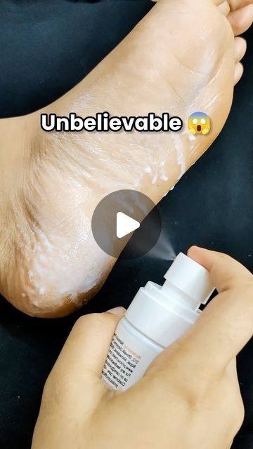 Sneha Sahoo | Fashion & Beauty Influencer on Instagram: "Comment link to get links 🔗 directly in your DM 

#reelsinstagram #trendingreels #reels #reelitfeelit #viral #makeup #skincare #pedicure #pedicures #reel #reelviral #viralskincare #deadskinremoval #deadskin 

Pedicure at home, skincare hacks, cracked heels, heels, skincare tips , foot spa , spa" At Home Skincare, Viral Makeup, Skincare Hacks, Dead Skin Removal, Pedicure At Home, Foot Spa, Cracked Heels, Beauty Influencer, Pedicures