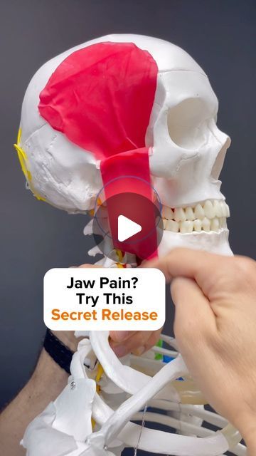 Dr. Joe Damiani - TMJ, Head & Neck Specialist on Instagram: "Have you been beating your master muscle into an oblivion?

 It’s pretty much your only strategy to release jaw, muscle pain and you’re just hammering away at it all day? 

Well, besides the Temporalis and Masseter, the Medial Pterygoid is one of the prime muscles involved in closing your mouth chewing or clenching. In this video, I show you how to get to that hard to reach Muscle to really push in there and Release Some Tension. 

I also show three separate strokes that you can use to get the most out of this release release in this muscle can help to decompress the TMJ and to make moving your mouth easier. 

🚨Most importantly, releasing muscles does not reverse TMJ disorder. It makes the muscles more healthy, but we must look How To Relax Jaw Muscles, Relax Jaw Muscles, Jaw Muscle Release, Scm Muscle Release, Temporalis Muscle, Leg Cramps Causes, Masseter Muscle, Tongue Muscles, Jaw Muscles