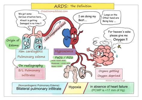 Topics - Creative Med Doses Focal Segmental Glomerulosclerosis, Acute Respiratory Distress, Physician Assistant School, Respiratory Distress, Duchenne Muscular Dystrophy, Arterial Blood Gas, Medicine Studies, Sjogrens Syndrome, Nurse Study Notes