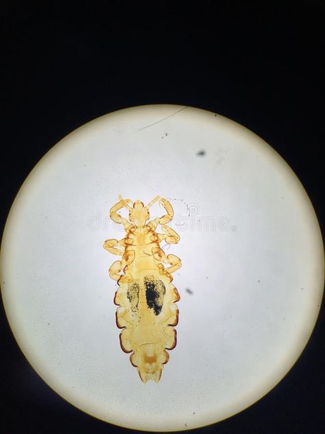 Head louse. Femal looking through the microscope #Sponsored , #sponsored, #Sponsored, #Head, #Femal, #microscope, #louse Under The Microscope, Head Louse, Business Icon, Business Icons, Business Icons Design, Design Typography, Icons Design, Typography Design, Photo Image