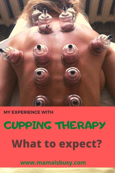 Cupping Therapy, Japanese Food, Health