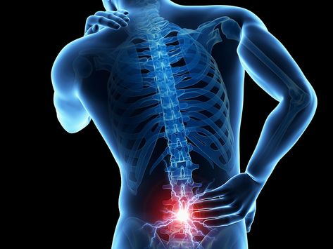 Sistem Saraf, Spine Care, Bolesti Chrbta, Spine Pain, Chronic Lower Back Pain, Chiropractic Clinic, Essential Oils For Pain, Spine Surgery, Sciatic Nerve Pain