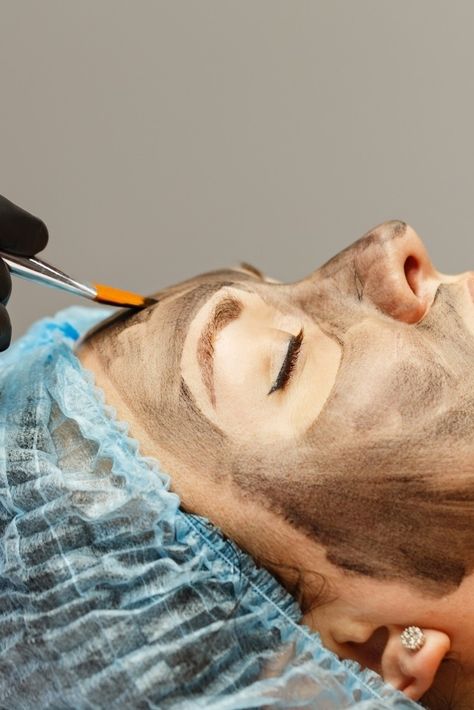 Carbon Laser Facial, Carbon Laser, Rf Microneedling, Laser Peel, Remove Skin Tags Naturally, Laser Facial, Upper Lip Hair, Top Treatments, Laser Tattoo