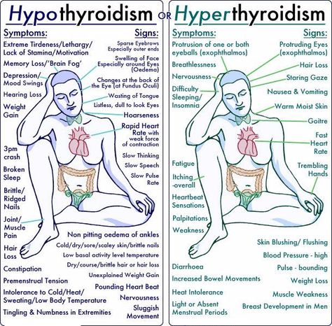 #Hyperthyroidism is a condition of the thyroid. The #thyroid is a small, butterfly-shaped gland located at the front of your neck.Whereas hyperthyroidism can cause symptoms such as sweating, feeling hot, palpitationsand weight loss - symptoms of thyroid storm are more severe, resulting in complications  Hyperthyroidism is a condition in which there is an excessive amount of thyroid hormones. Graves Disease, Nursing School Notes, Nursing Tips, Nursing Study, Thyroid Health, Nursing Notes, Nursing Education, Endocrine System, Medical Knowledge