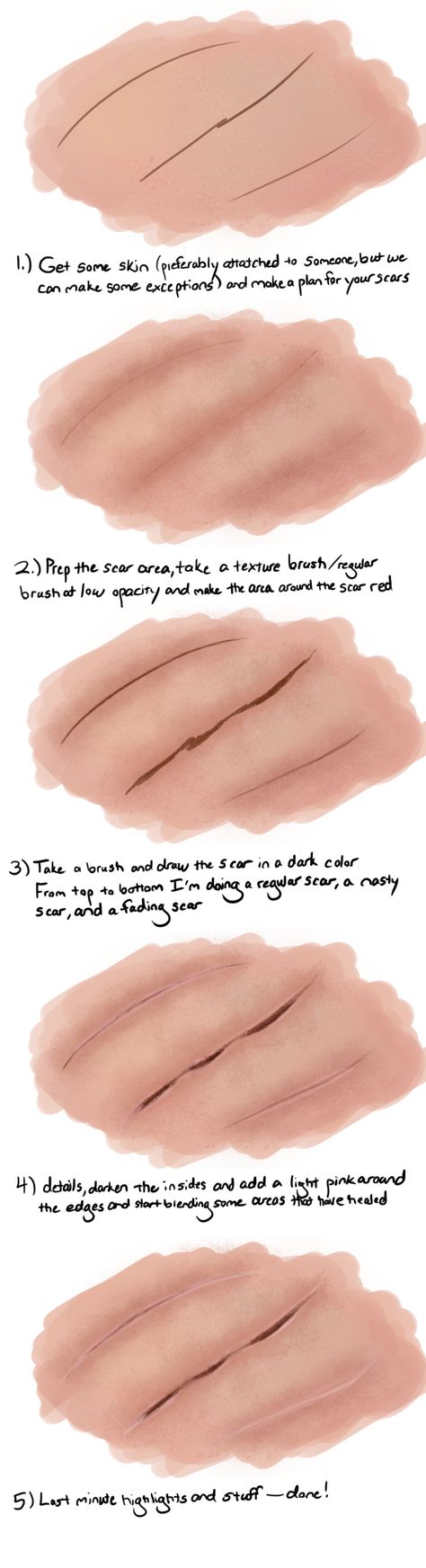 Scar Tutorial, How To Draw Scars, Losing 40 Pounds, Cold Sores Remedies, Natural Sleep Remedies, Natural Cold Remedies, Natural Cough Remedies, Cold Home Remedies, Cold Remedies