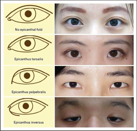 Epicanthic Fold, Drawing Face Expressions, Drawing Eye, Draw Eyes, Art Advice, Drawing Eyes, Face Drawing Reference, Types Of Eyes, Human Anatomy Art