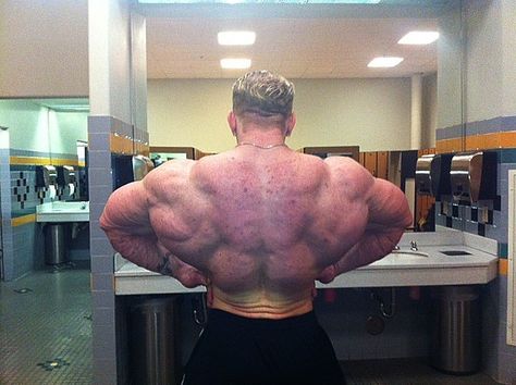 Bodybuilders - if you use steroids, expect to have acne over your beautiful muscles. Steroids Side Effects, Steroids Cycles, Competition Prep, Anabolic Steroids, Increase Muscle Mass, Big Muscles, Athletic Performance, Lean Muscle, Muscle Growth