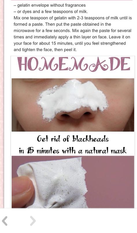 Diy Pore Strips, Black Head Removal, Best Peel Off Mask, Homemade Pore Strips, Chocolate Face Mask, Face Diy, Blackhead Remover Diy, Natural Mask, Acne Face