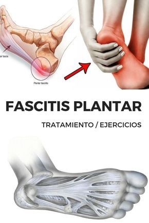 CURAR FASCITIS PLANTAR ¿Sientes DOLOR EN EL TALÓN? ¿Te dijeron que sufres FASCITIS PLANTAR? ¿Quieres descubrir los MEJORES TRUCOS para PREVENIR y CURAR esta maldita LESIÓN?En este artículo vamos a darte los mejores consejos para prevenir y curar la FASCITIS PLANTAR. Facitis Plantar, Health Food Store, 30 Minute Workout, Massage Techniques, Reflexology, Acupressure, Alternative Medicine, Massage Therapy, Health Coach