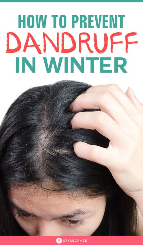 How To Prevent Dandruff, Prevent Dandruff, How To Treat Dandruff, Dandruff Solutions, Dandruff Remedy, Getting Rid Of Dandruff, Diy Hair Masks, Winter Air, Hair Dandruff