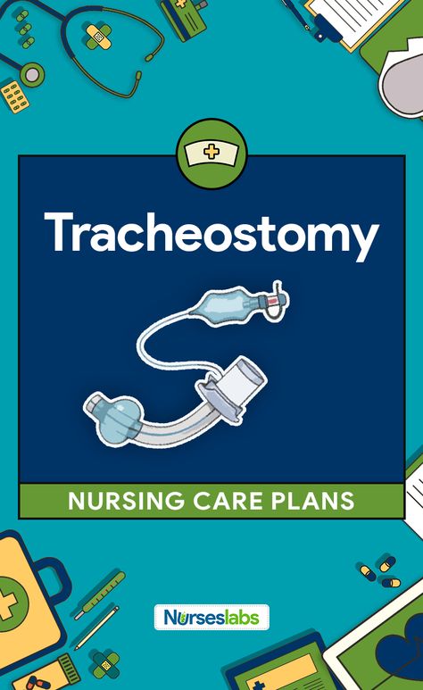 Tracheostomy Nursing Care Plans Delegation Nursing, Nursing Respiratory, Nursing School Clinicals, Nursing Flashcards, Nursing School Prerequisites, Nursing 101, Nursing Information, Oncology Nurse, Nursing Diagnosis